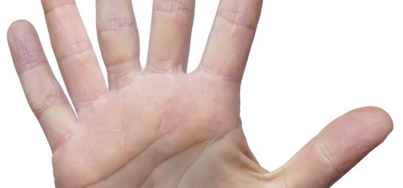 A hand with six fingers.