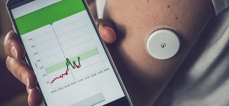 Woman with glucose monitoring device on arm and phone tracking blood sugar