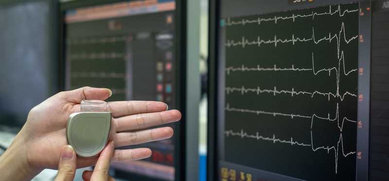A hand holding a pacemaker.