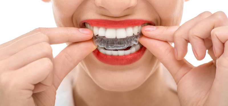 A person puts in a clear teeth straightening retainer.