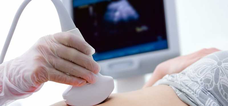 Woman having an ultrasound.