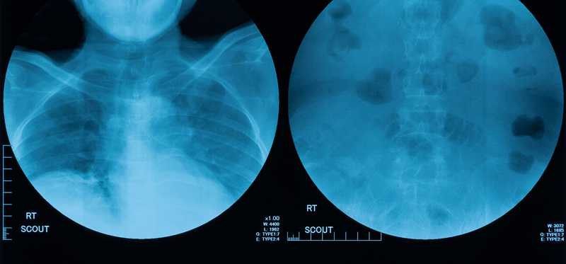 A sheet of x-ray images.